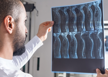 Spinal Cord Injuries Image